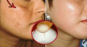 बिहान उठेर मुख धुँदा साबुनको सट्टा यी चिज प्रयोग गर्नाले मिल्नेछ प्राकृतिक सुन्दरता